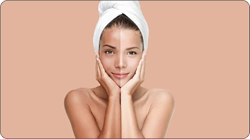 Full Body Skin Whitening Treatment