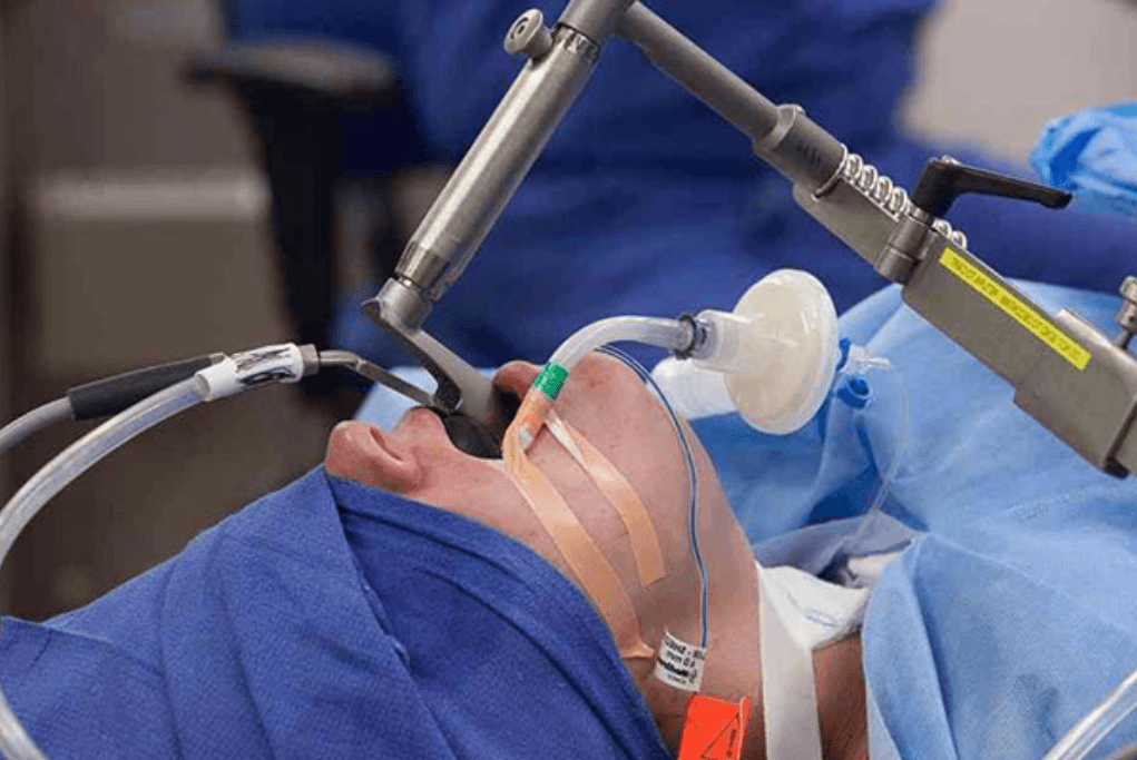 LASER VOICE SURGERY